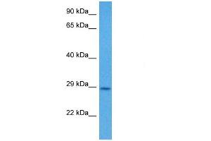 Host:  Mouse  Target Name:  CSNK2B  Sample Tissue:  Mouse Skeletal Muscle  Antibody Dilution:  1ug/ml