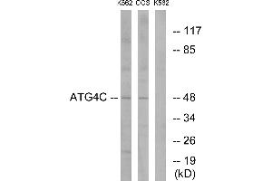 Immunohistochemistry analysis of paraffin-embedded human liver carcinoma tissue using ATG4C antibody.
