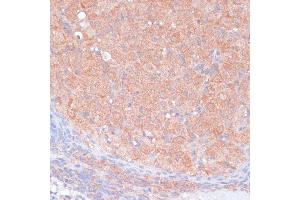 Immunohistochemistry of paraffin-embedded rat ovary using LRP1 antibody (ABIN3021968, ABIN3021969, ABIN3021970 and ABIN6218530) at dilution of 1:100 (40x lens).