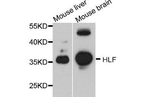 Western blot analysis of extract of mouse liver and mouse brain cells, using HLF antibody. (HLF 抗体)