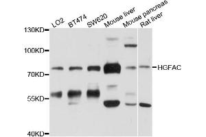 Western blot analysis of extracts of various cell lines, using HGFAC antibody. (HGFA 抗体)