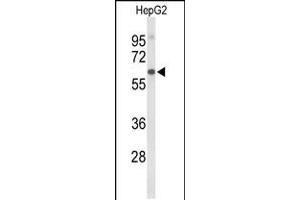 Western blot analysis of AFM Antibody in HepG2 cell line lysates (35ug/lane) (Afamin 抗体  (N-Term))