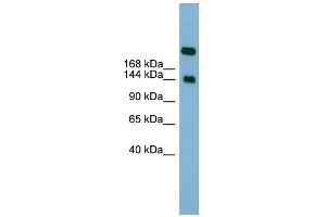 WB Suggested Anti-SI Antibody Titration:  0. (SI 抗体  (Middle Region))