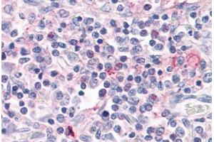 Anti-ROR Gamma antibody  ABIN1049302 IHC staining of human thymus.