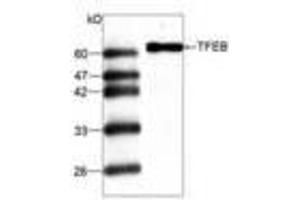 Image no. 1 for anti-Transcription Factor EB (TFEB) antibody (ABIN791477) (TFEB 抗体)