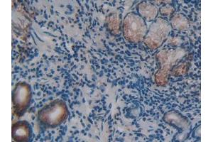 DAB staining on IHC-P; Samples: Human Stomach Tissue (REG3g 抗体  (AA 87-175))
