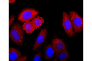 HepG2 cells were fixed in paraformaldehyde, permeabilized with 0. (CDK1 抗体)