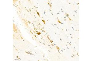 Immunohistochemistry of paraffin embedded mouse heart using SMYD2 (ABIN7075581) at dilution of 1:2000 (400x lens) (SMYD2A 抗体)