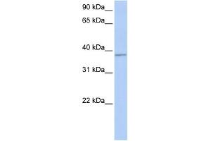 WB Suggested Anti-FGFR1OP Antibody Titration: 0. (FGFR1OP 抗体  (Middle Region))