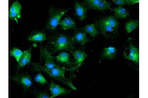 Anti-TUBAL3 mouse monoclonal antibody (ABIN2455275) immunofluorescent staining of COS7 cells transiently transfected by pCMV6-ENTRY TUBAL3 (RC216194). (TUBAL3 抗体  (AA 150-446))