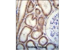 Immunohistochemistry (Paraffin-embedded Sections) (IHC (p)) image for anti-C-Type Lectin Domain Family 3, Member B (CLEC3B) (AA 95-122) antibody (ABIN656570)