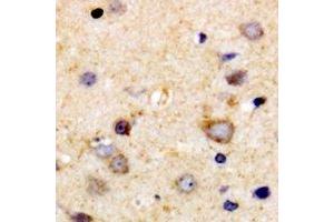 Immunohistochemical analysis of VEGFR3 staining in human brain formalin fixed paraffin embedded tissue section. (FLT4 抗体)