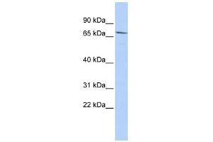 MELK antibody used at 1 ug/ml to detect target protein. (MELK 抗体  (Middle Region))