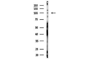 anti-Diacylglycerol Kinase, theta 110kDa (DGKQ) (C-Term) antibody