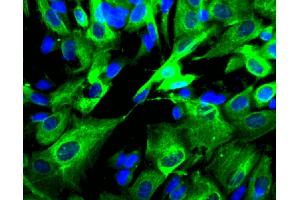 Immunofluorescent staining of SK-N-SH cells (Human neuroblastoma, ATCC HTB-11) (right). (AP2B1 抗体  (AA 75-245))