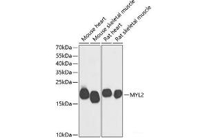 Western blot analysis of extracts of various cell lines using MYL2 Polyclonal Antibody at dilution of 1:500. (MYL2 抗体)