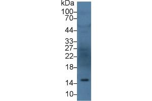 Detection of ANG in Human Serum using Polyclonal Antibody to Angiogenin (ANG) (ANG 抗体  (AA 25-147))