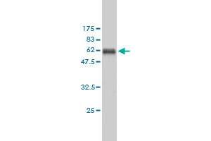 Western Blotting (WB) image for anti-Proliferating Cell Nuclear Antigen (PCNA) (AA 1-261) antibody (ABIN562135)
