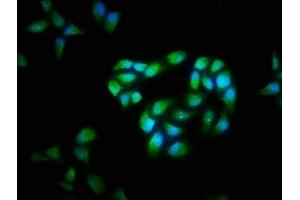 Immunofluorescence staining of Hela cells with ABIN7146901 at 1:40, counter-stained with DAPI. (FLIP 抗体  (AA 1-250))