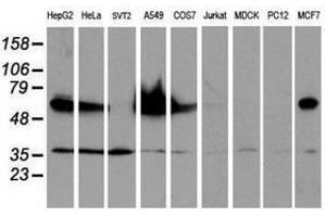 Image no. 2 for anti-Epsin 2 (EPN2) antibody (ABIN1498049) (Epsin 2 抗体)