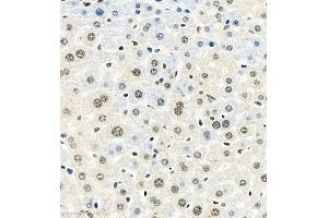 Immunohistochemistry of paraffin embedded mouse liver using HIF-3α (ABIN7074273) at dilution of 1:1600 (400x lens) (HIF3A 抗体)