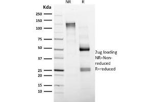 SDS-PAGE Analysis Purified CD4 Mouse Monoclonal Antibody (CD4/1604). (CD4 抗体  (AA 245-392))