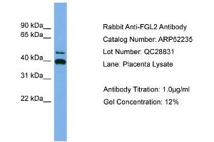 WB Suggested Anti-FGL2  Antibody Titration: 0.