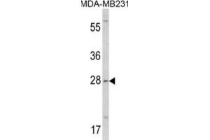 Western Blotting (WB) image for anti-Collectin Sub-Family Member 11 (COLEC11) antibody (ABIN3002827) (COLEC11 抗体)