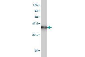 Western Blotting (WB) image for anti-Non-Metastatic Cells 1, Protein (NM23A) Expressed in (NME1) (AA 43-152) antibody (ABIN562004)