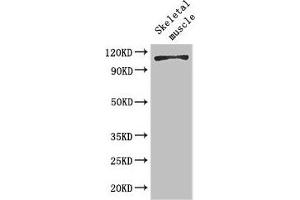 Western Blot Positive WB detected in: Mouse skeletal muscle tissue All lanes: EPHB6 antibody at 2 μg/mL Secondary Goat polyclonal to rabbit IgG at 1/50000 dilution Predicted band size: 111, 82, 58 kDa Observed band size: 111 kDa (EPH Receptor B6 抗体  (AA 410-553))
