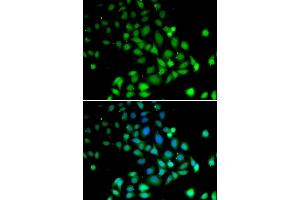 Immunofluorescence analysis of U2OS cells using PARN antibody (ABIN1681249, ABIN3018397, ABIN3018398 and ABIN6220460). (PARN 抗体  (AA 1-280))