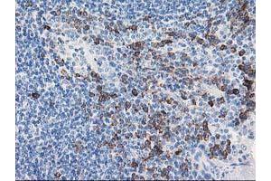 Image no. 1 for anti-Aryl Hydrocarbon Receptor Interacting Protein-Like 1 (AIPL1) antibody (ABIN1496508) (AIPL1 抗体)