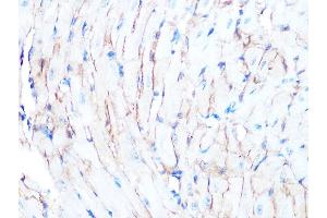 Immunohistochemistry of paraffin-embedded mouse heart using Dystrophin Rabbit mAb (ABIN7266871) at dilution of 1:100 (40x lens). (Dystrophin 抗体)