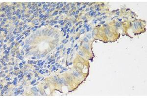 Immunohistochemistry of paraffin-embedded Human appendix using CLN5 Polyclonal Antibody at dilution of 1:150 (40x lens). (CLN5 抗体)