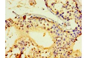 Immunohistochemistry of paraffin-embedded human testis tissue using ABIN7143026 at dilution of 1:100 (ACRV1 抗体  (AA 22-265))
