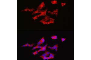 Immunofluorescence analysis of SH-SY5Y cells using GNRH1 Rabbit pAb (ABIN6131875, ABIN6141257, ABIN6141258 and ABIN6221260) at dilution of 1:200 (40x lens). (GNRH1 抗体  (AA 24-92))