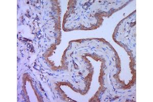 Paraformaldehyde-fixed, paraffin embedded rat bladder, Antigen retrieval by boiling in sodium citrate buffer (pH6. (PKC theta 抗体  (AA 351-450))