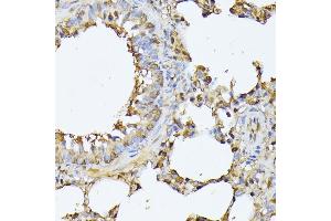 Immunohistochemistry of paraffin-embedded rat lung using PSMB3 antibody (ABIN6131929, ABIN6146317, ABIN6146318 and ABIN6225280) at dilution of 1:100 (40x lens). (PSMB3 抗体  (AA 1-205))