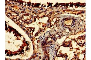 Immunohistochemistry of paraffin-embedded human lung tissue using ABIN7147484 at dilution of 1:100 (CDR2 抗体  (AA 1-454))