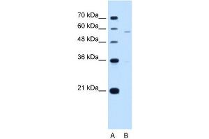 PIGV antibody used at 1 ug/ml to detect target protein. (PIGV 抗体  (N-Term))