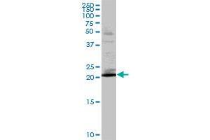 RAB32 MaxPab polyclonal antibody. (RAB32 抗体  (AA 1-225))