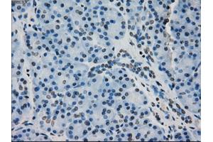 Immunohistochemical staining of paraffin-embedded pancreas tissue using anti-CRYABmouse monoclonal antibody. (CRYAB 抗体)