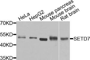 Western blot analysis of extracts of various cell lines, using SETD7 antibody. (SETD7 抗体)