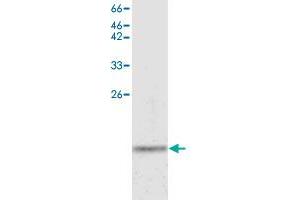Western blot analysis of HepG2 whole cell lystae with ARHGDIB monoclonal antibody, clone 7  at 1:500 dilution.