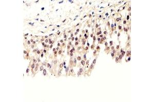 Immunohistochemical analysis of paraffin-embedded H. (Pan SUMO 抗体)