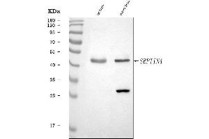 Western blot analysis of SEPT4/SEPTIN4 using anti-SEPT4/SEPTIN4 antibody (ABIN7600345).
