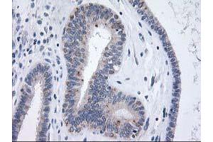 Immunohistochemistry (IHC) image for anti-X-Prolyl Aminopeptidase (Aminopeptidase P) 3, Putative (XPNPEP3) antibody (ABIN1501765) (XPNPEP3 抗体)