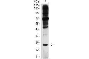 Western Blotting (WB) image for anti-BCL2-Associated X Protein (BAX) antibody (ABIN7193613)