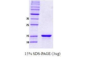 Figure annotation denotes ug of protein loaded and % gel used. (SNCG 蛋白)