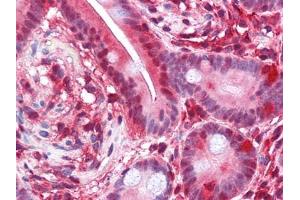 Immunohistochemical analysis of paraffin-embedded human Small Intestine tissues using PAR4 antibody (F2RL3 抗体  (AA 1-330))